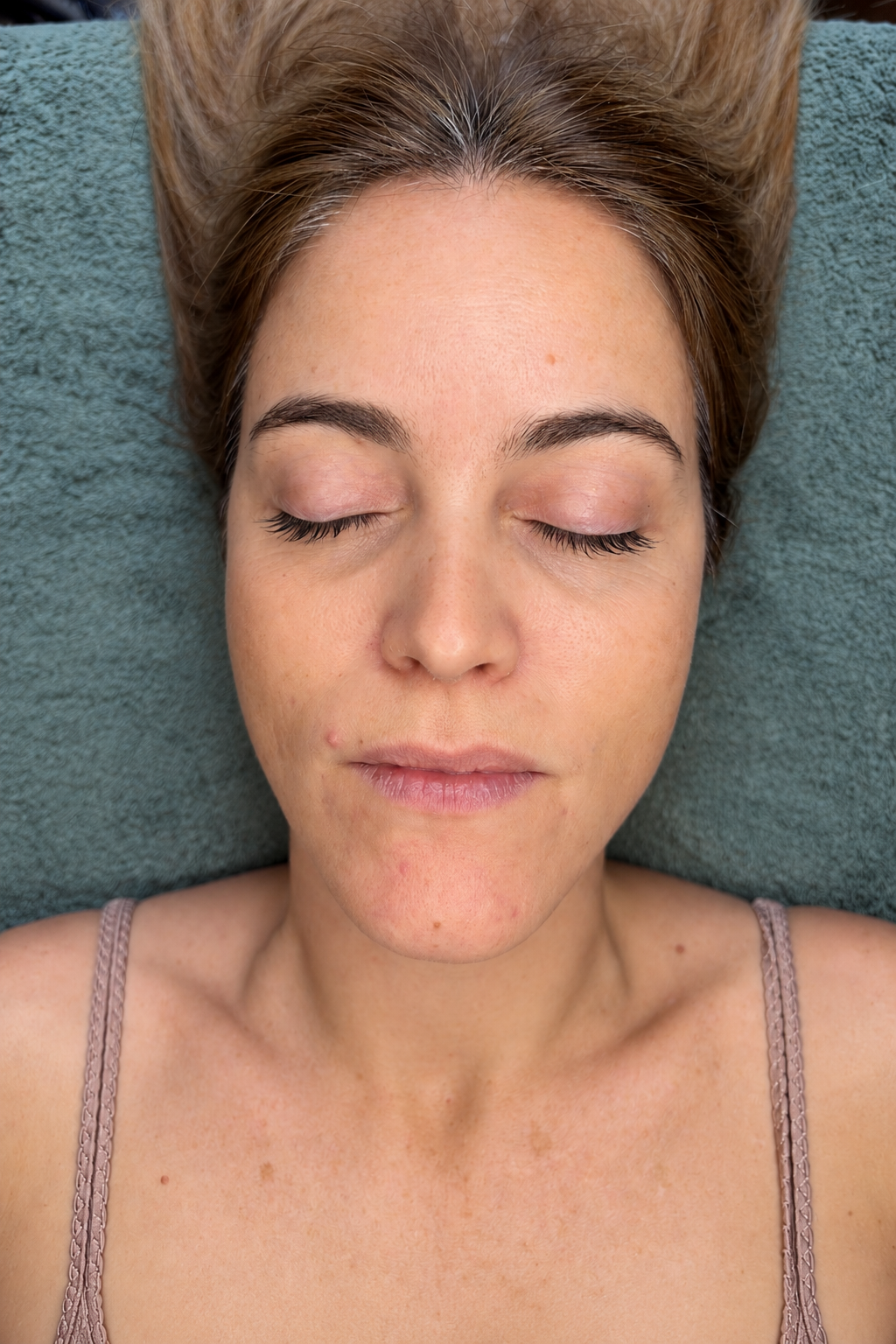 Visage avant le soin